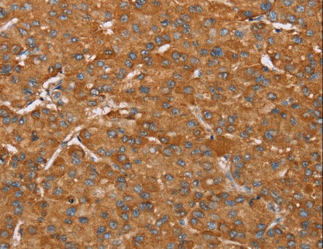 PAGE5 Antibody