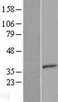 EMC2 / TTC35 Protein (Over-Expression Lysate Myc-DDK (Flag))
