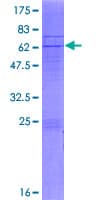 Human COQ2 Protein (Recombinant GST)