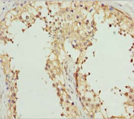 Polyclonal Rabbit anti-Human REEP1 Antibody (IHC, WB)
