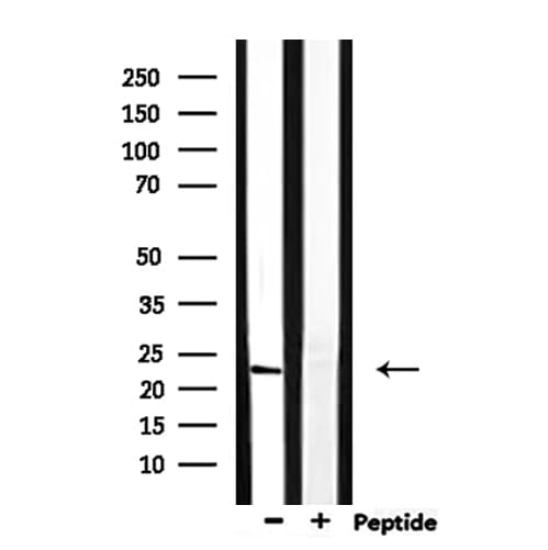 RAB13 Antibody