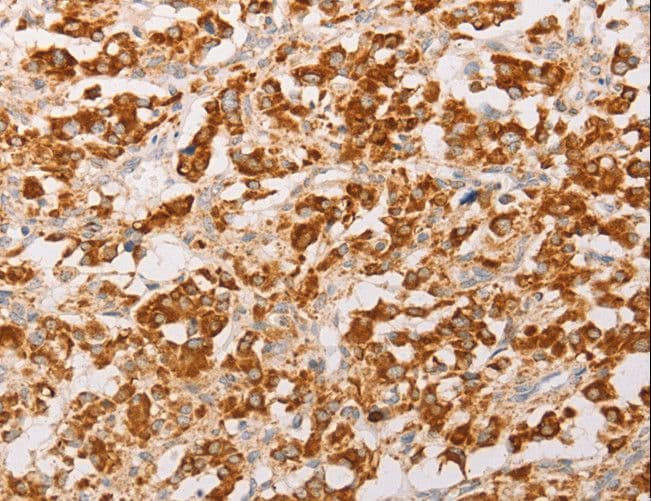 Polyclonal Rabbit anti-Human AK2 / Adenylate Kinase 2 Antibody (IHC, WB)