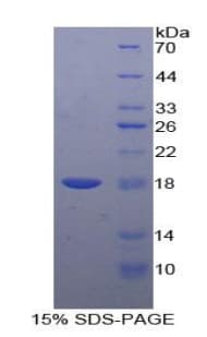Human CEA / Carcinoembryonic Antigen Protein (Recombinant His)