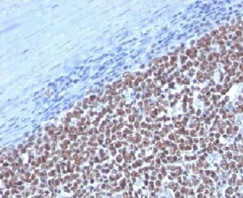 CCNB1 / Cyclin B1 Antibody (clone CCNB1/1098)