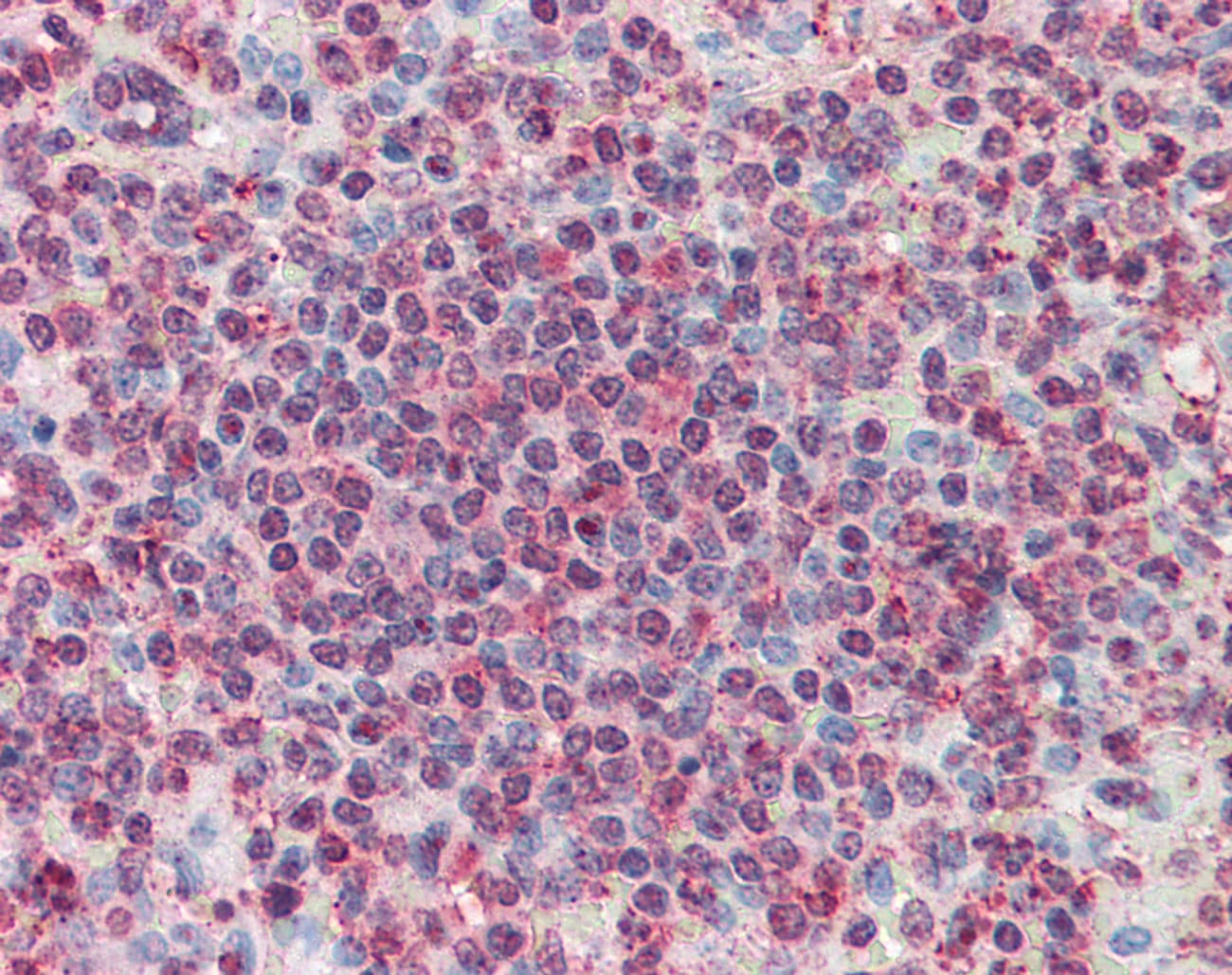IHC-plus™ CD27L / CD70 Antibody (Internal)