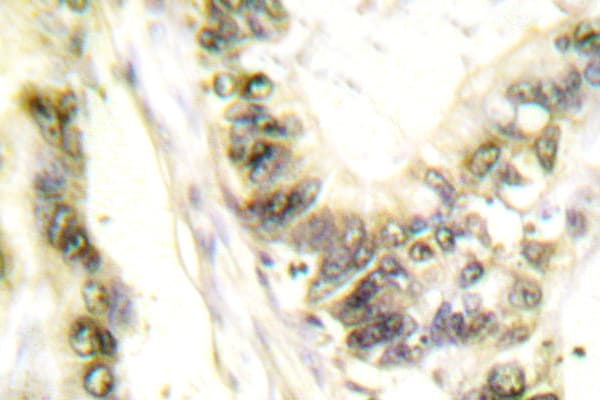 Polyclonal Rabbit anti-Human THRA / THR Alpha Antibody (Ala19, IHC, WB)
