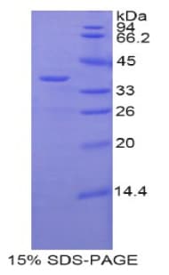 Mouse ZAP70 Protein (Recombinant His-T7)