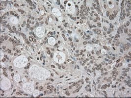 Monoclonal Mouse anti-Human BUB1B / BubR1 Antibody (clone OTI10B7, IHC, IF, WB)
