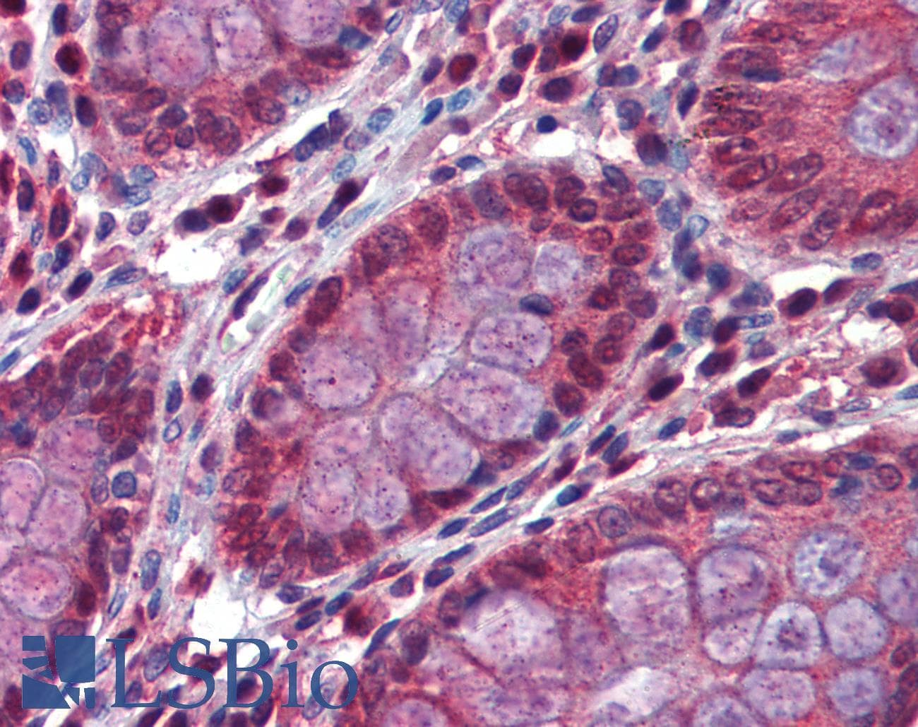 IHC-plus™ GSTP1 / GST Pi Antibody