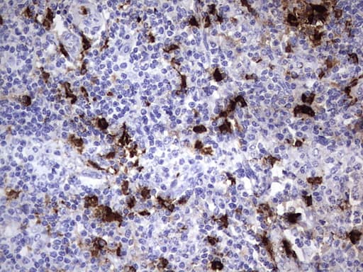 Monoclonal Mouse anti-Human S100A9 / MRP14 Antibody (clone OTI10D5, IHC, WB)