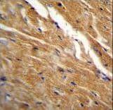 Polyclonal Rabbit anti-Human TBC1D13 Antibody (aa76-105, IHC, IF, WB)