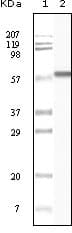 Monoclonal Mouse anti-Human CSNK1E / CK1 Epsilon Antibody (clone 3C10F7, IHC, WB)