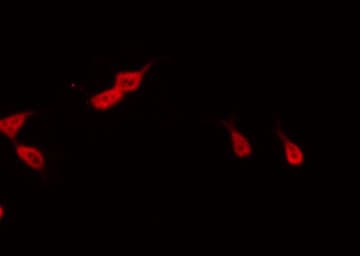 CDC25C Antibody (phospho-Ser216)