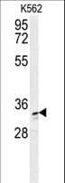 DDX / AKR1C3 Antibody (aa10-36)