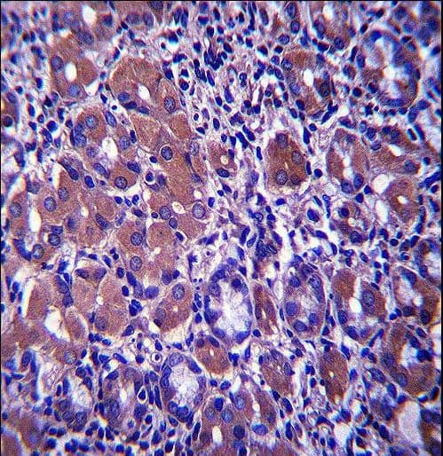 B4GALNT3 Antibody (aa555-584)