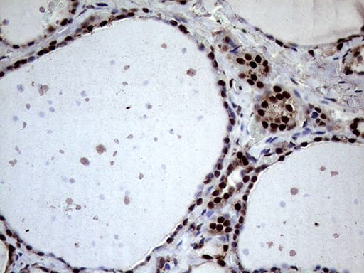 XRN2 Antibody (aa677-779, clone OTI5F4)