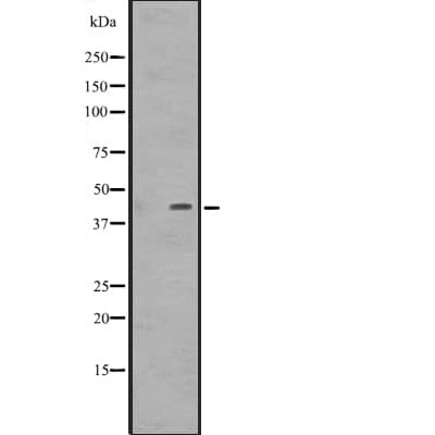 DMRTB1 Antibody