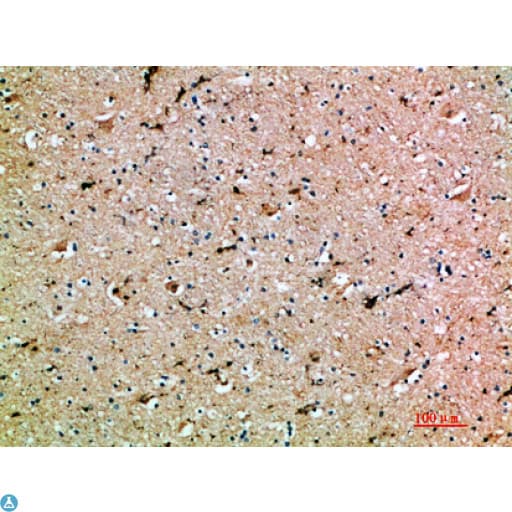 OSM / Oncostatin M Antibody
