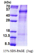 Human CCNI / Cyclin I Protein (Recombinant His)