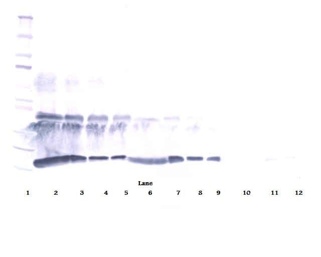 Polyclonal Rabbit anti-Human CSF1 / MCSF Antibody (WB)