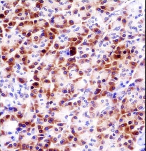 PRSS27 / CAPH2 Antibody (aa182-211)
