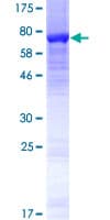 Human TUBB7P Protein (Recombinant GST)