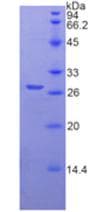 Human TMPRSS2 / Epitheliasin Protein (Recombinant His,N-terminus)