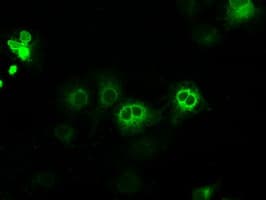 Monoclonal Mouse anti-Human CYPOR / POR Antibody (clone OTI1B11, IHC, IF, WB)