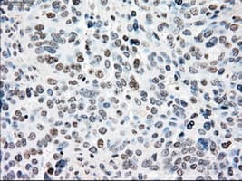 NRBP1 / NRBP Antibody (clone OTI5C3)