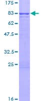 Human CORO1C Protein (Recombinant GST)