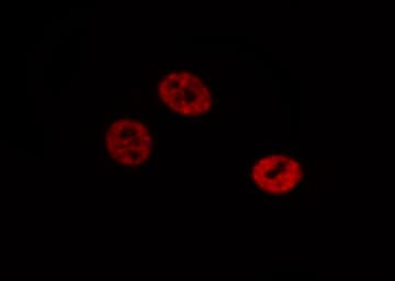 RTCD1 / RPC Antibody