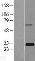 FBXO44 Protein (Over-Expression Lysate Myc-DDK (Flag))