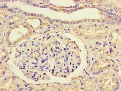 Polyclonal Rabbit anti-Human TFIIB Antibody (WB)