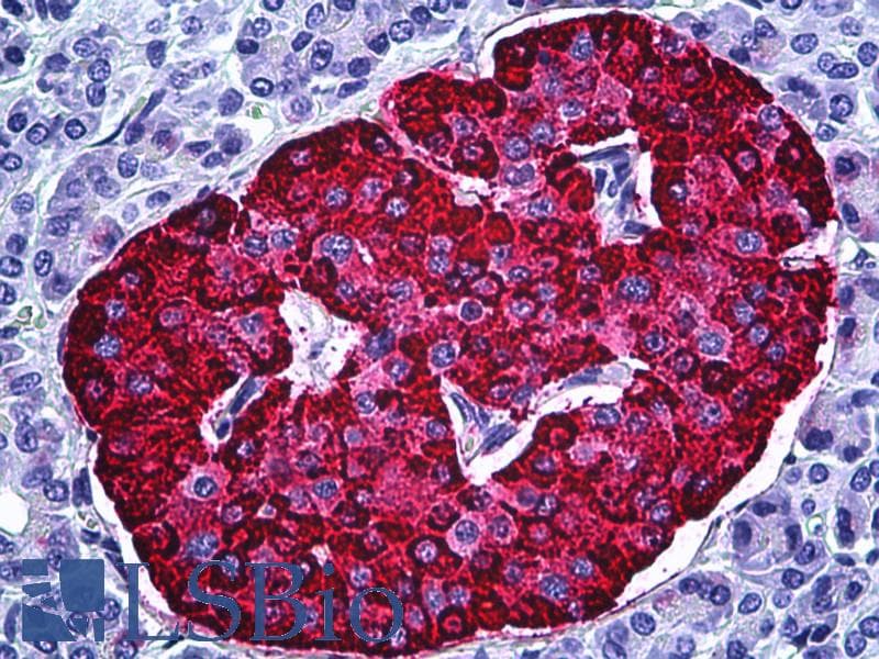 PathPlus™ CHGA / Chromogranin A Antibody (clone LK2H10, Concentrated)