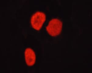Polyclonal Rabbit anti-Human HDAC6 Antibody (phospho-Ser22, IHC, IF, WB)