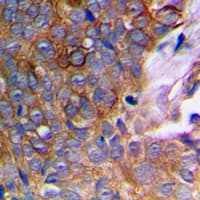 MMP10 Antibody (C-Terminus)