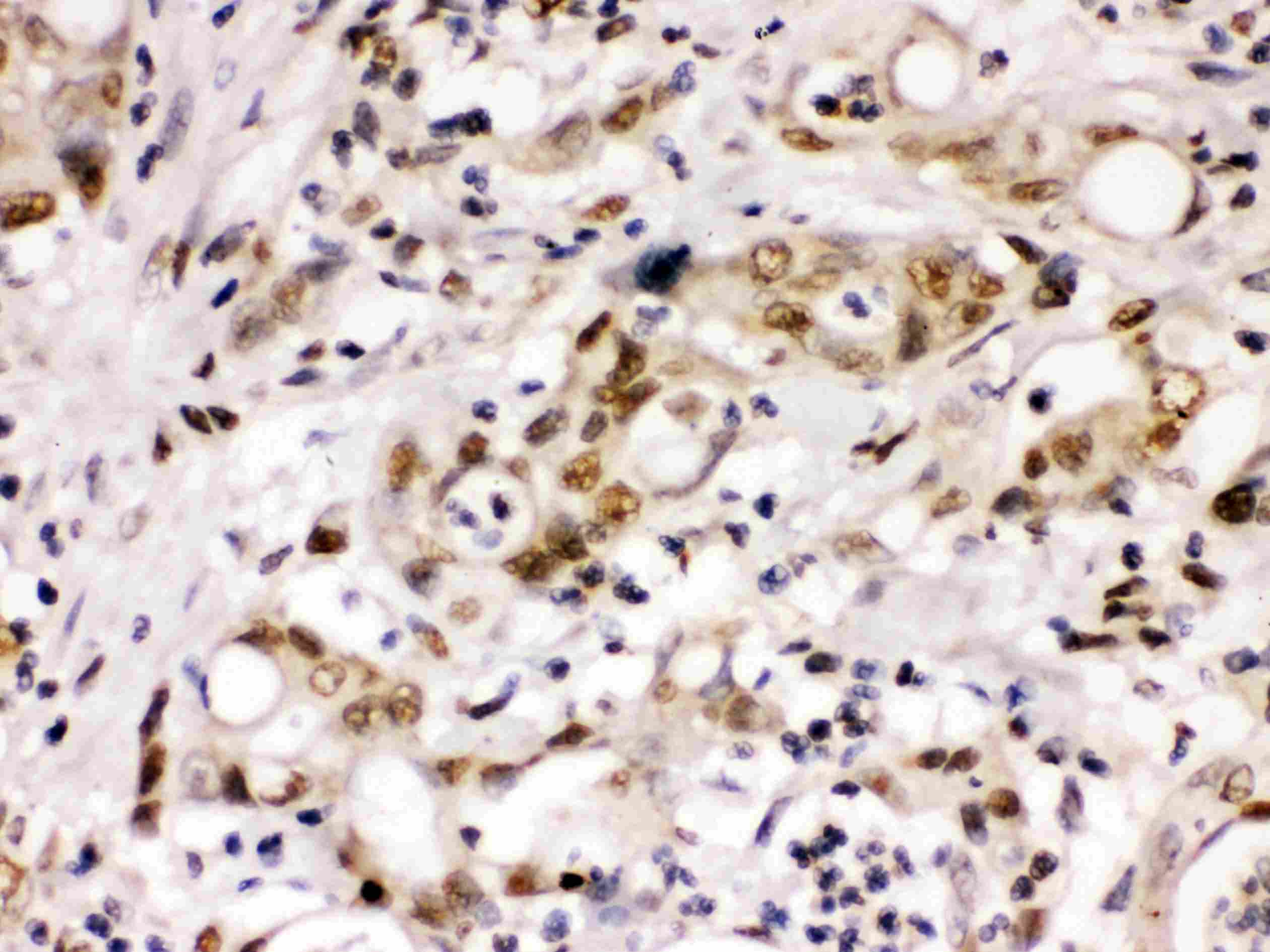 CCNT1 / Cyclin T1 Antibody