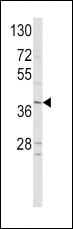 Polyclonal Rabbit anti-Human NEUROD1 Antibody (aa15-45, IHC, IF, WB)