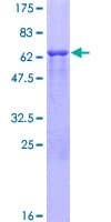Human Osteonectin / SPARC Protein (Recombinant GST)