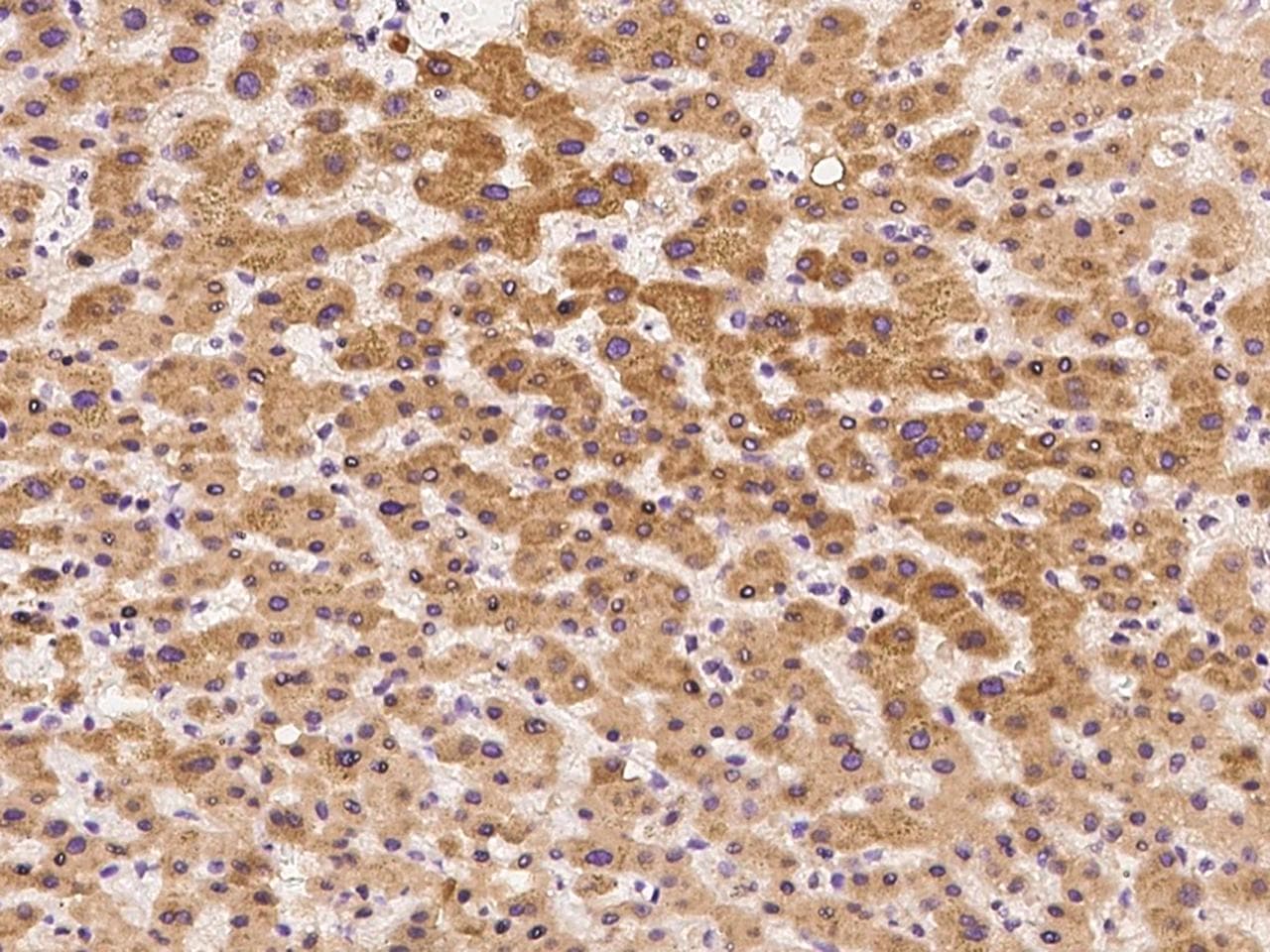 ALDH3A2 Antibody