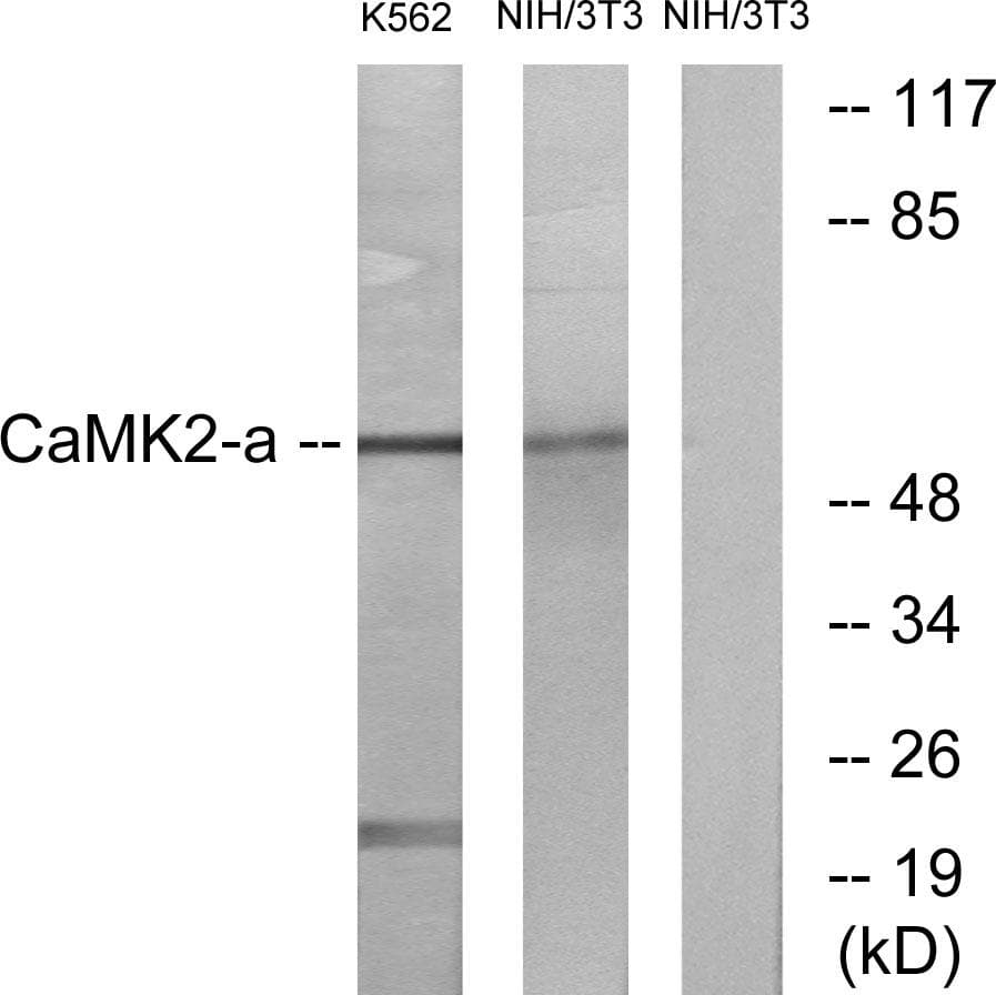 CaMKII Alpha+Delta Antibody (Ab-286)