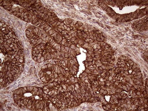 Monoclonal Mouse anti-Human IQGAP1 Antibody (clone OTI7F5, aa464-609, IHC, WB)