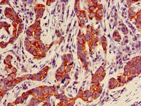 KRT18 / CK18 / Cytokeratin 18 Antibody (Biotin)