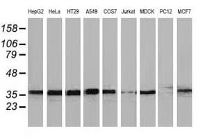 Monoclonal Mouse anti-Human UBXN2B Antibody (clone OTI3H8, WB)