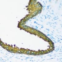 NEDD4 Antibody