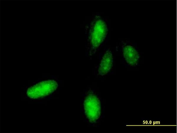 HOXC10 Antibody (clone 3F2)