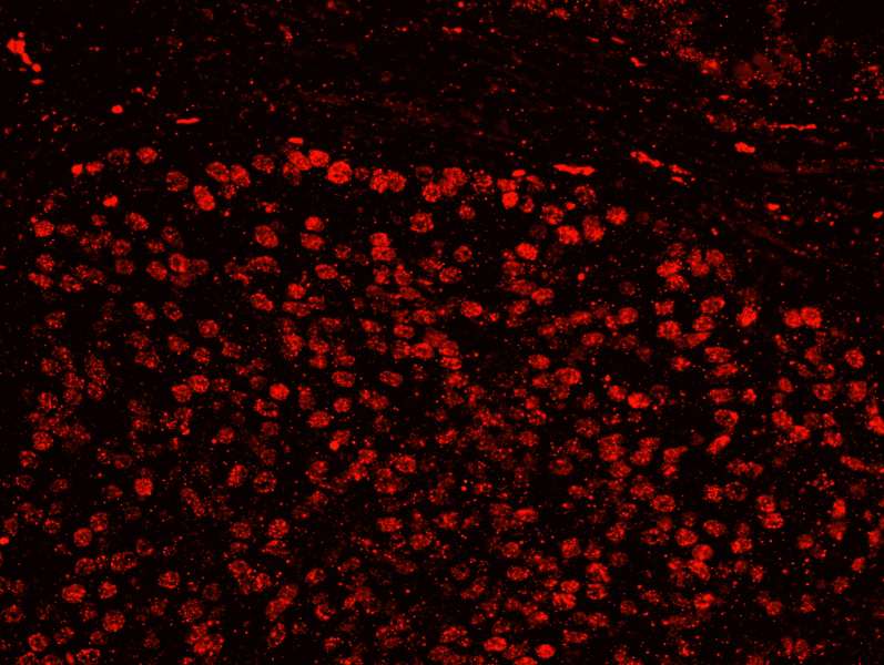 Polyclonal Rabbit anti-Human SUGP2 / SFRS14 Antibody (aa725-775, IHC, IF)
