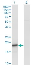 Monoclonal Mouse anti-Human SNCA / Alpha-Synuclein Antibody (clone 2E4, WB)