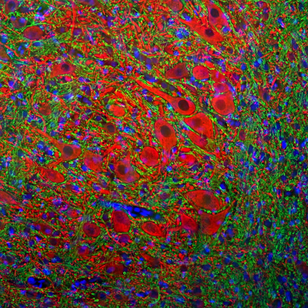 MAP2 Antibody
