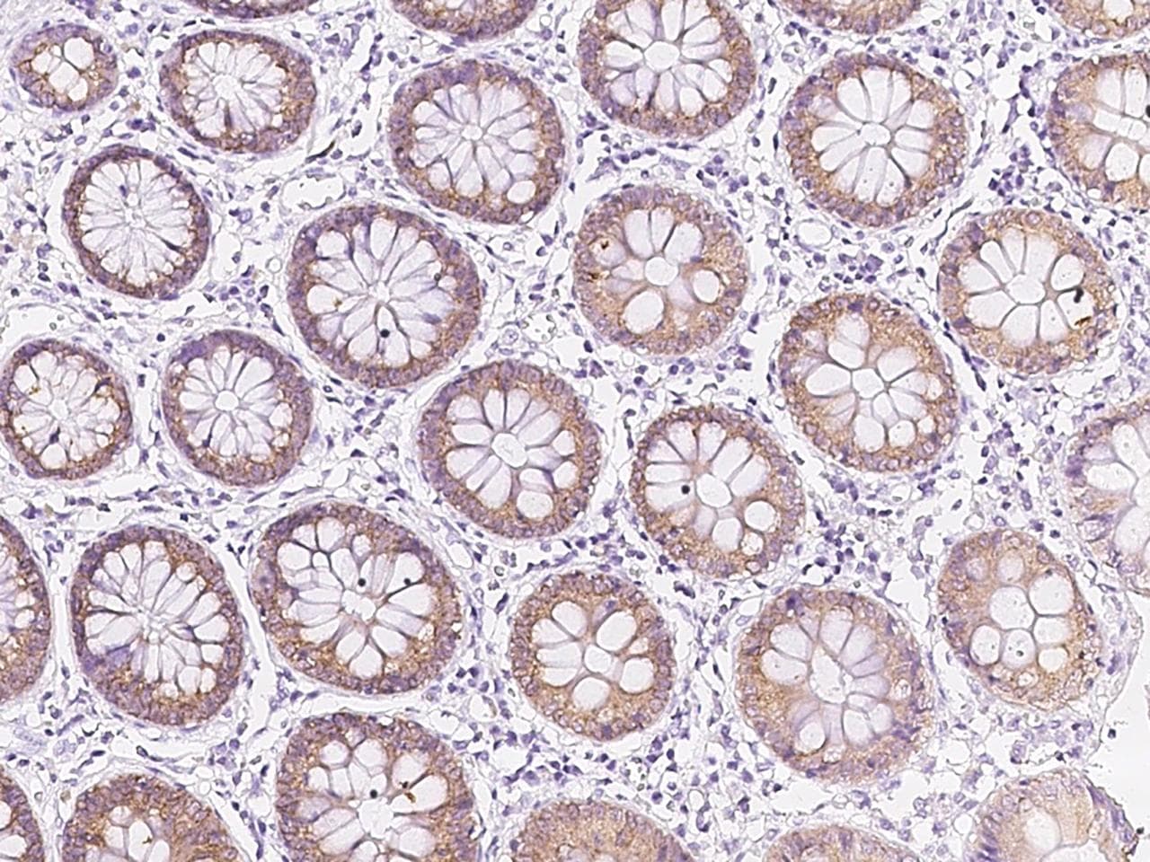 Polyclonal Rabbit anti-Human AGR2 Antibody (IHC)